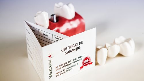 Implant dentar – o interventie necesara