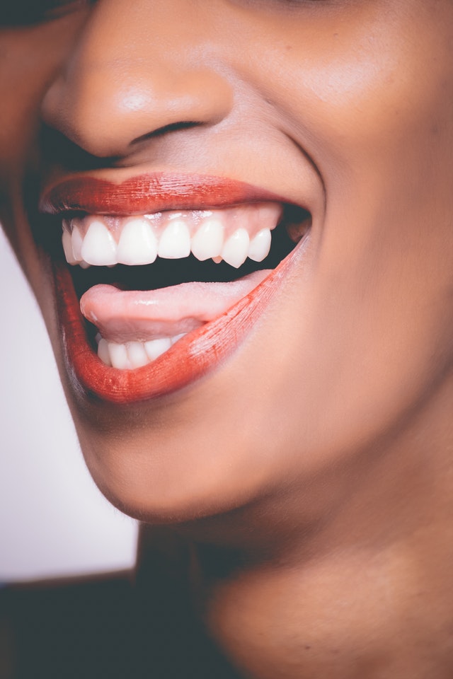 Fatete dentare – cea mai eficienta varianta de imbunatatire a zambetului