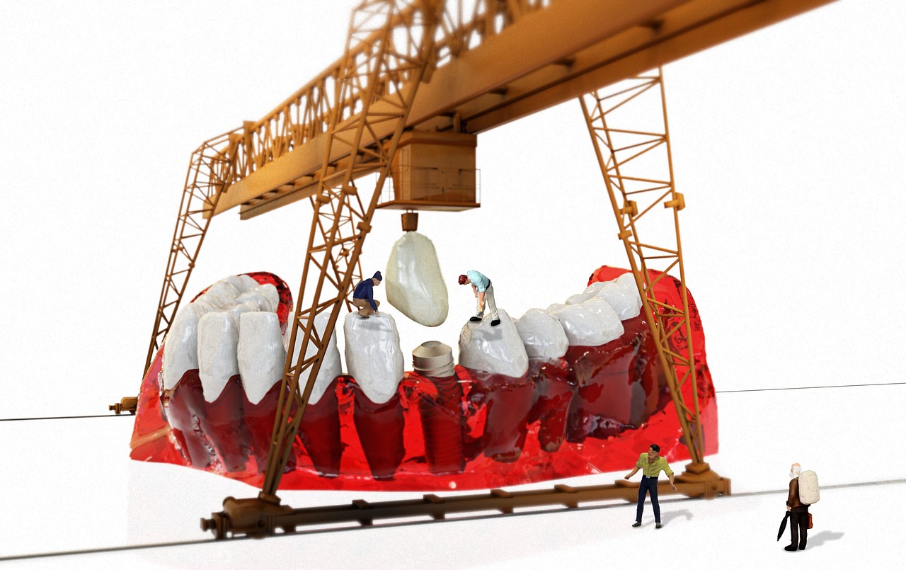 Etapele esentiale ale tratamentului cu implant dentar. Este o procedura dureroasa?